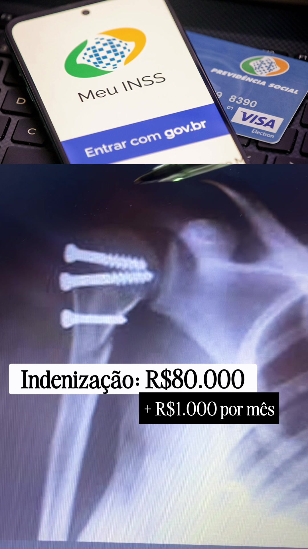@Ana Paula Rolim| Advogada INSS