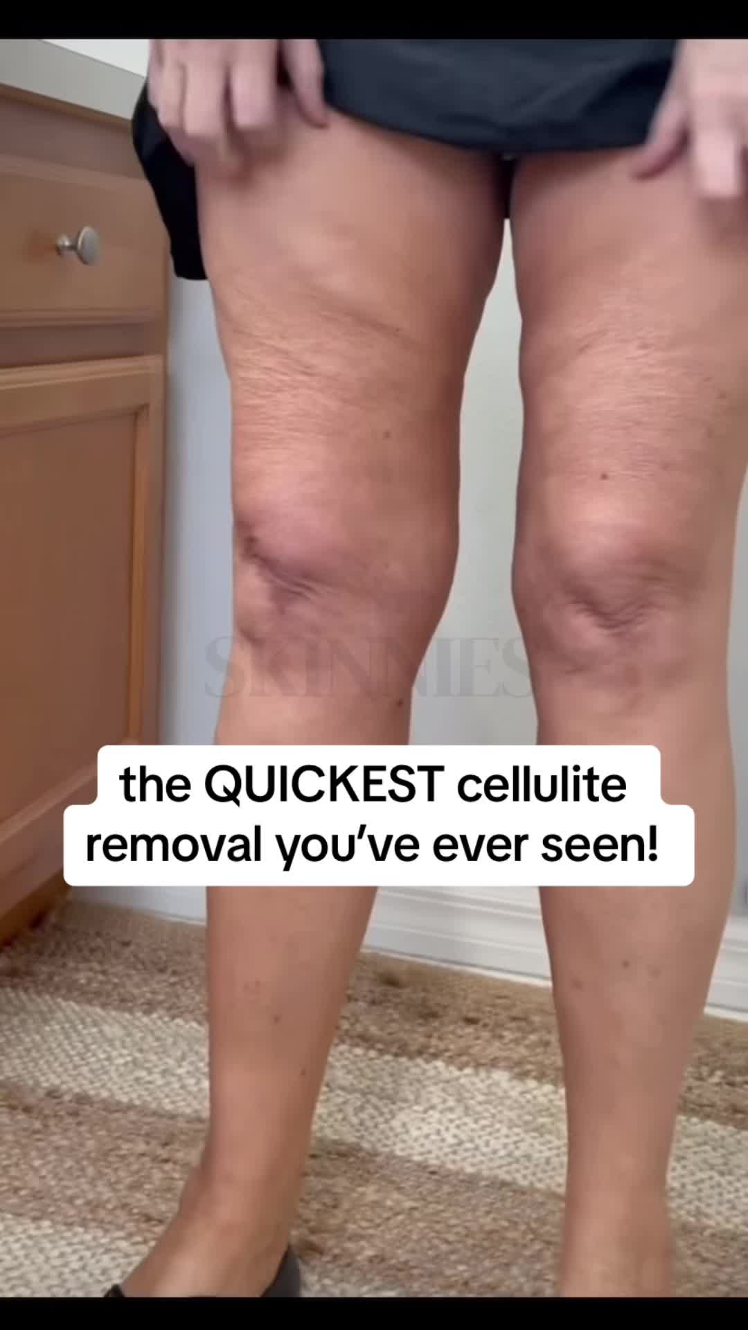 @Skinnies InstantLifts