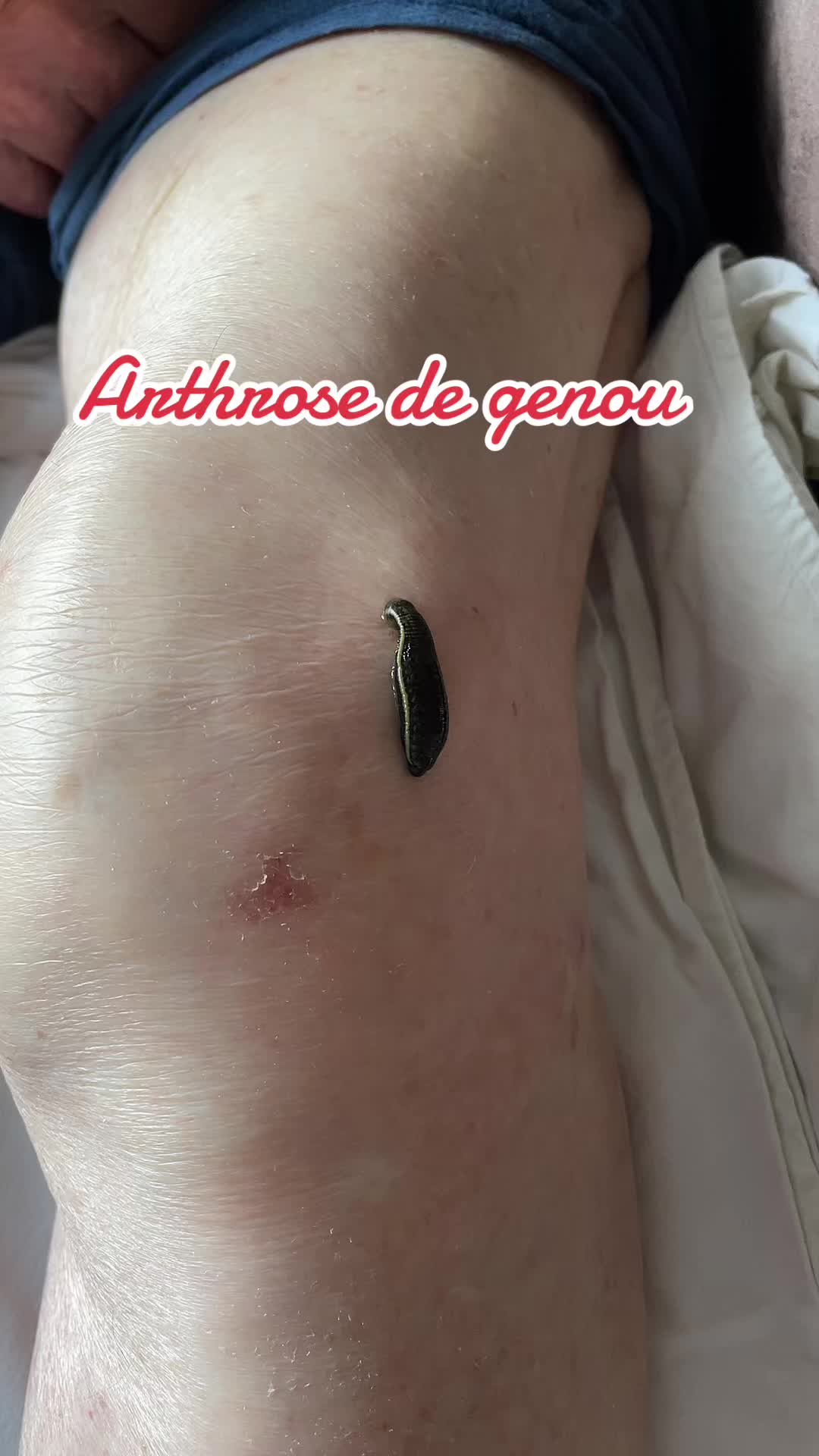 @Emyphysio🌺