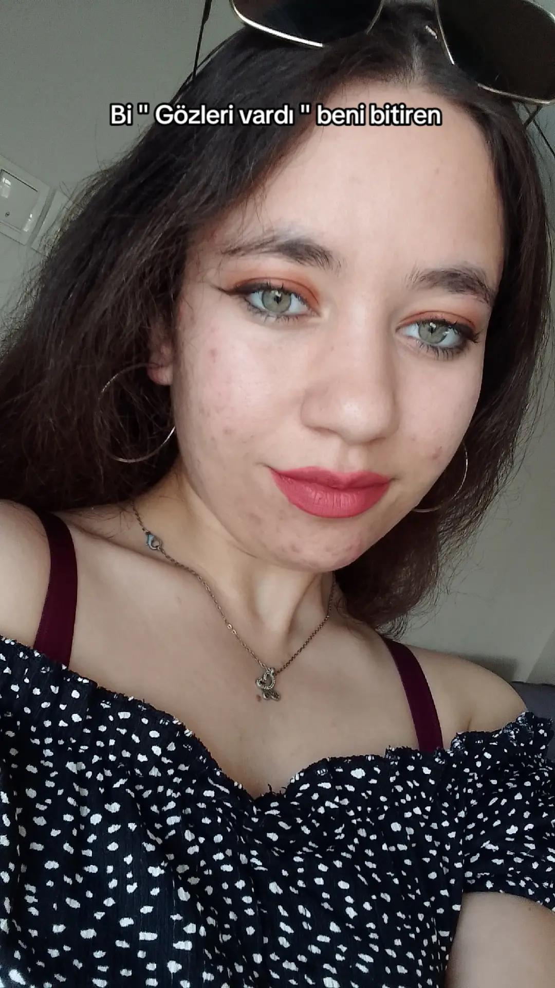 @𝒊𝒑𝒆𝒌kk🎀