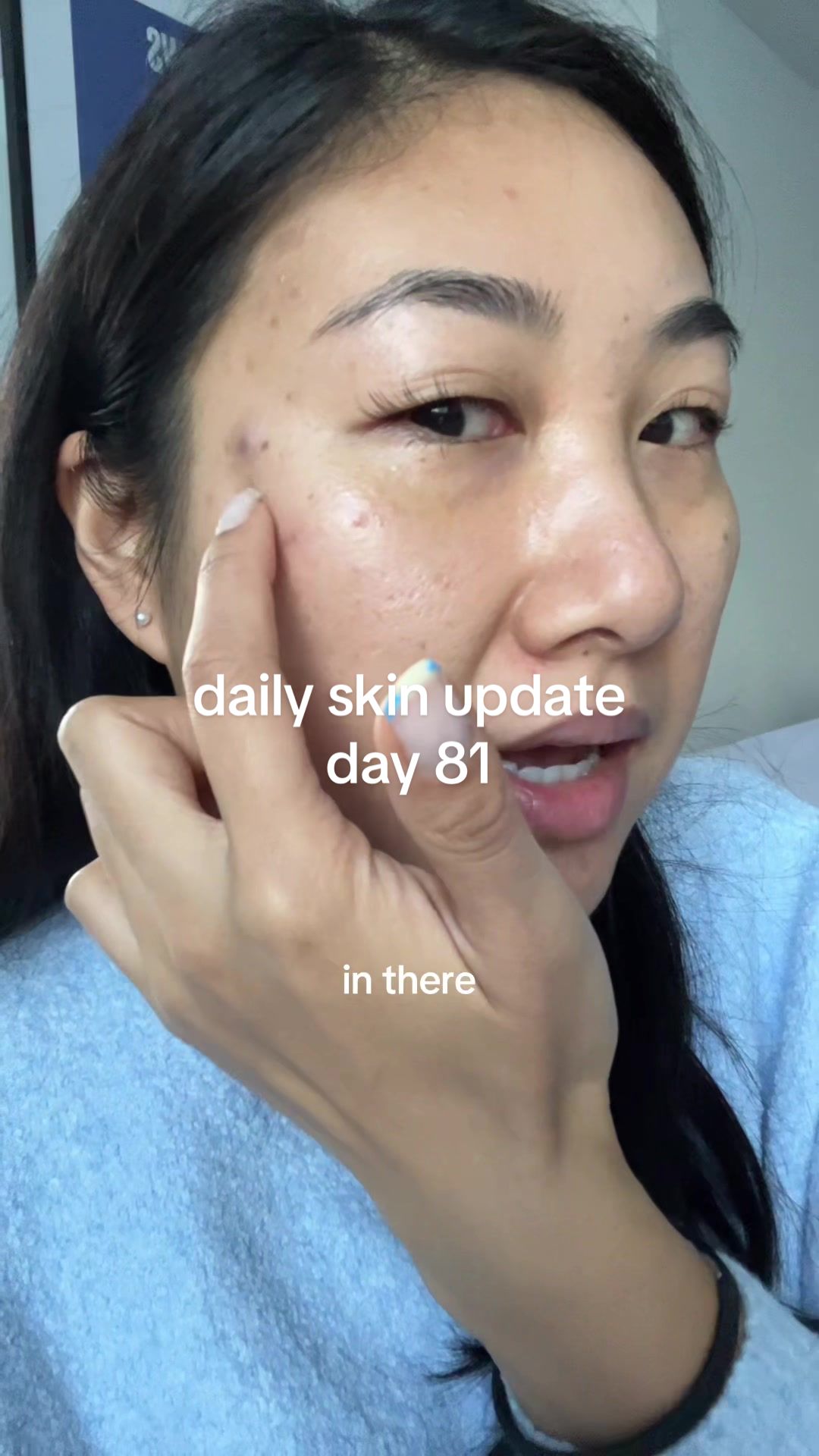 @Lisa | skincare + new mum life