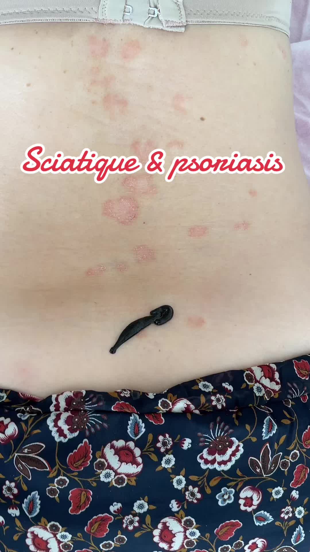 @Emyphysio🌺