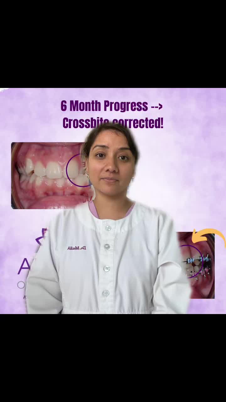 @Amaya Orthodontics