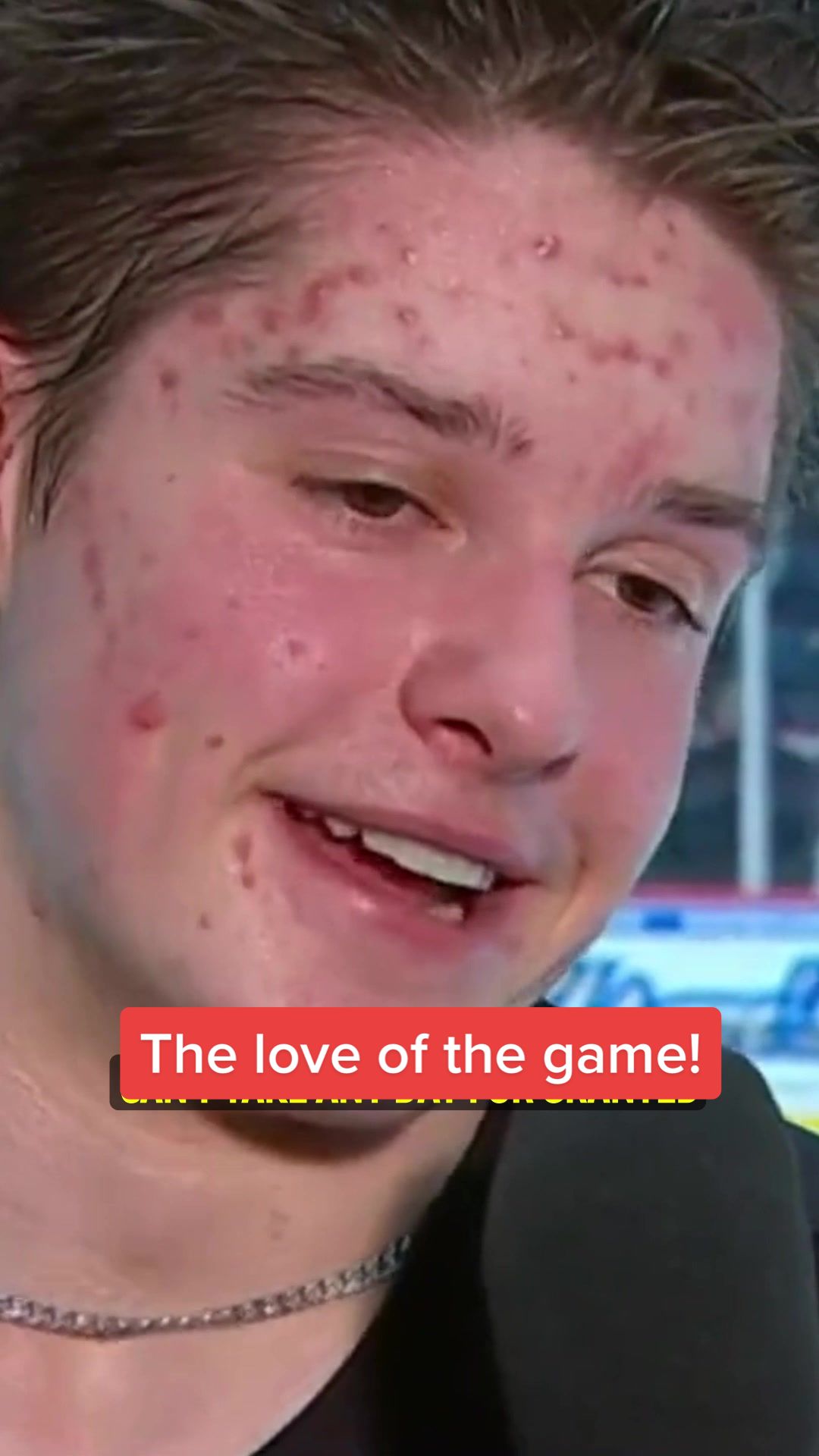 @BarDown