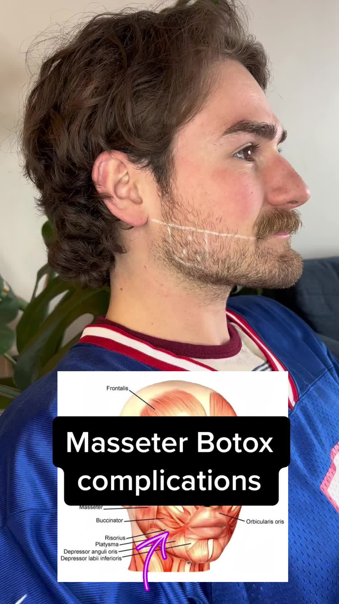 @mw_aesthetic_injector
