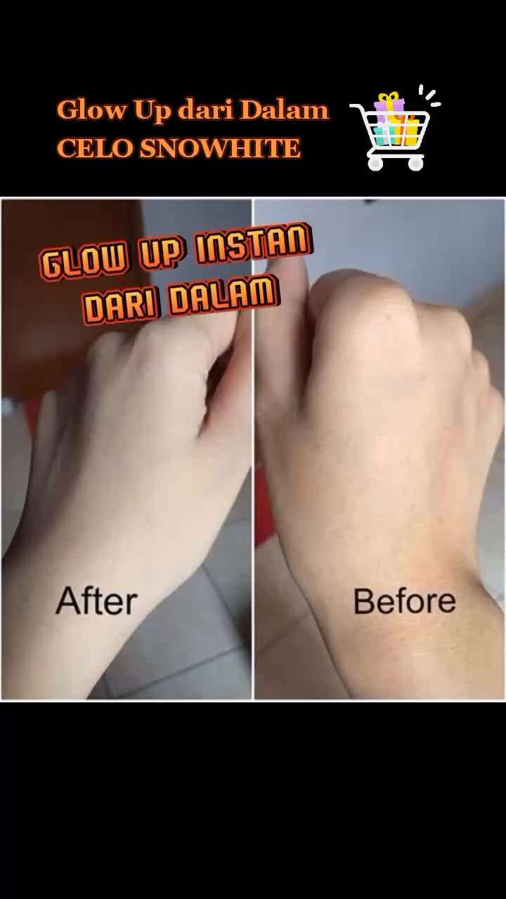 @Glowiee