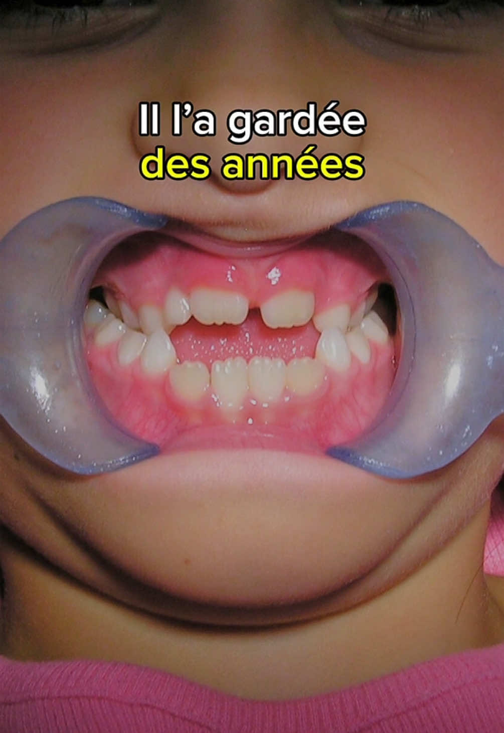 @MACHOUYOU