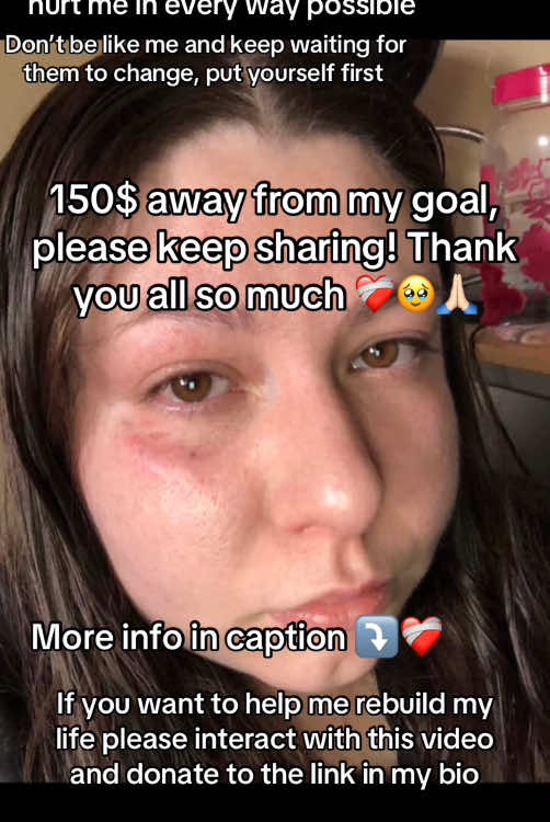 @Ggs Backup