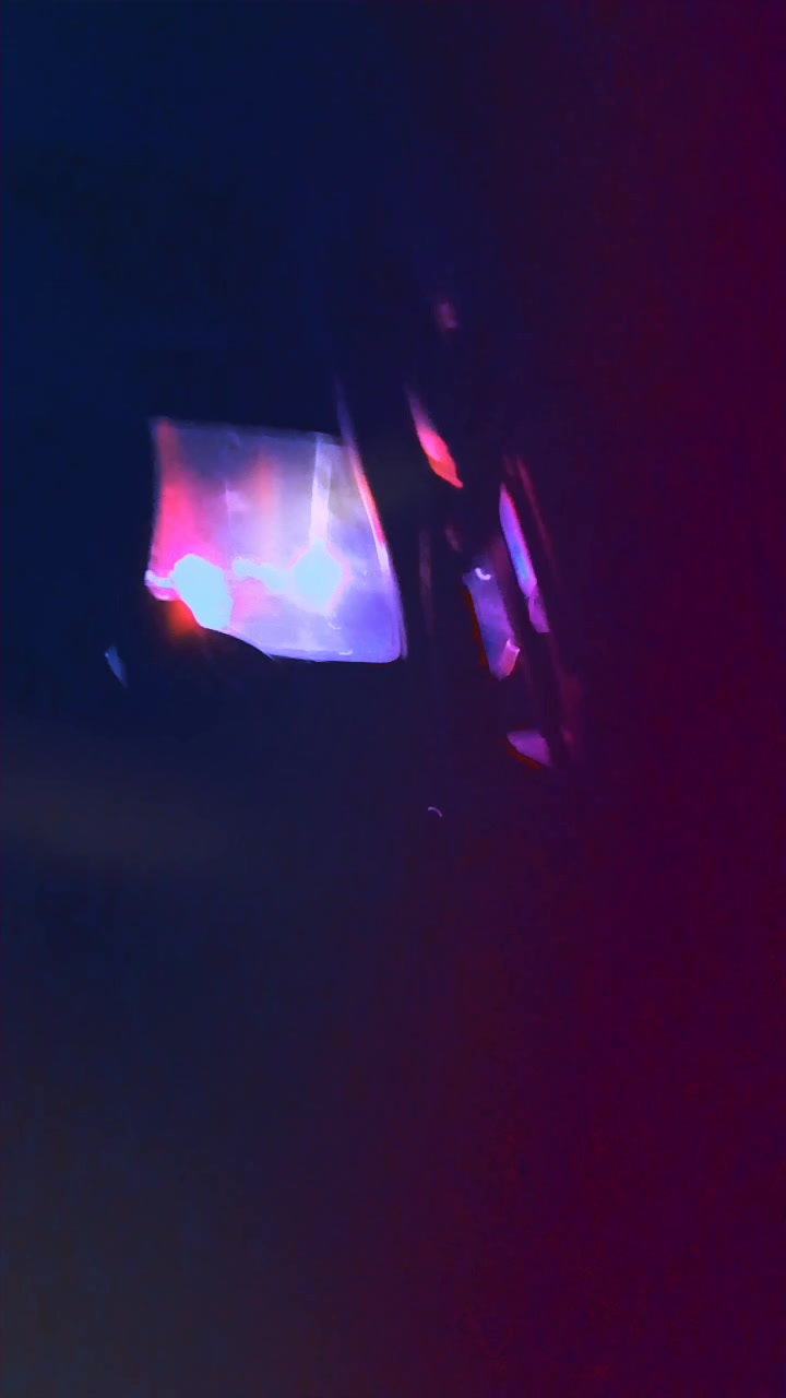 @🩸B̶Ⱡ𝑶𝒐Đ M̶&Oslash;o̶ᴺ🌕