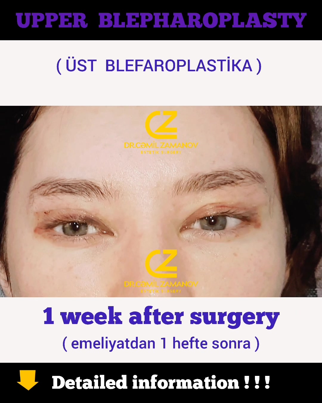 @Dr.Zamanov_Cemil