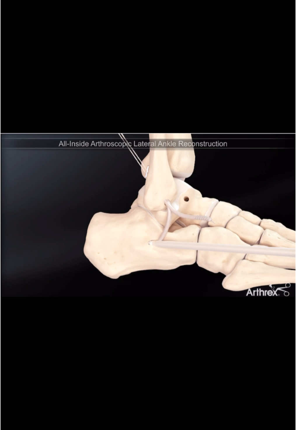 @Anatomias