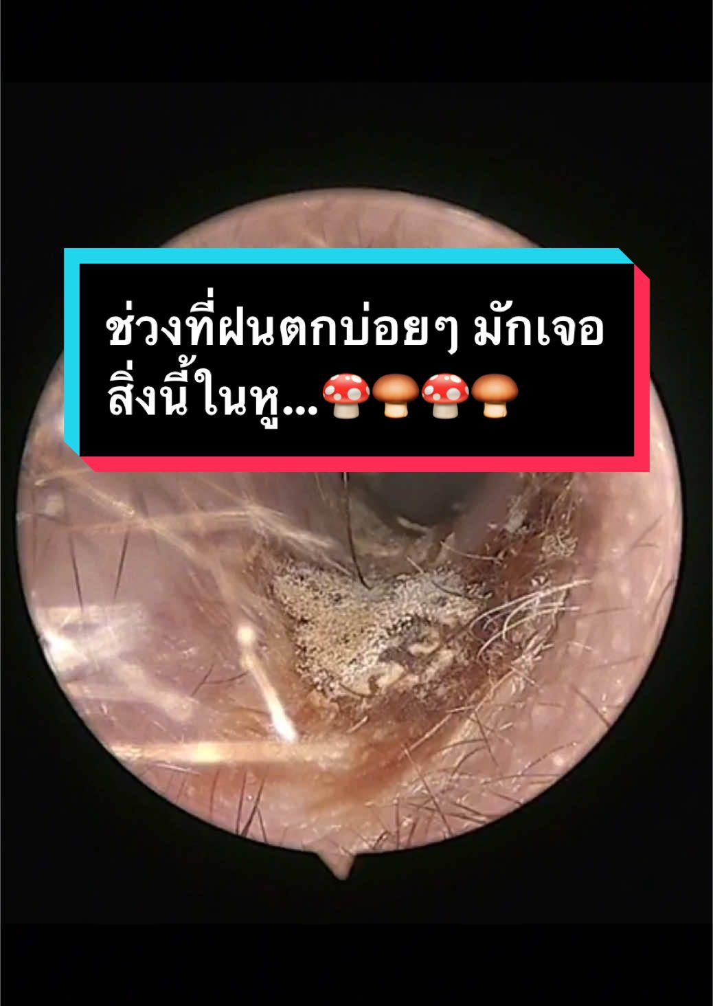 @คลินิกหมอณัฐธยาน์ หู คอ จมูก