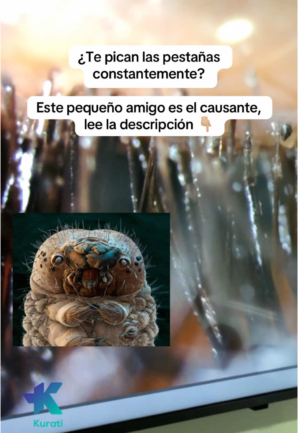 @Kurati | Oftalmolog&iacute;a