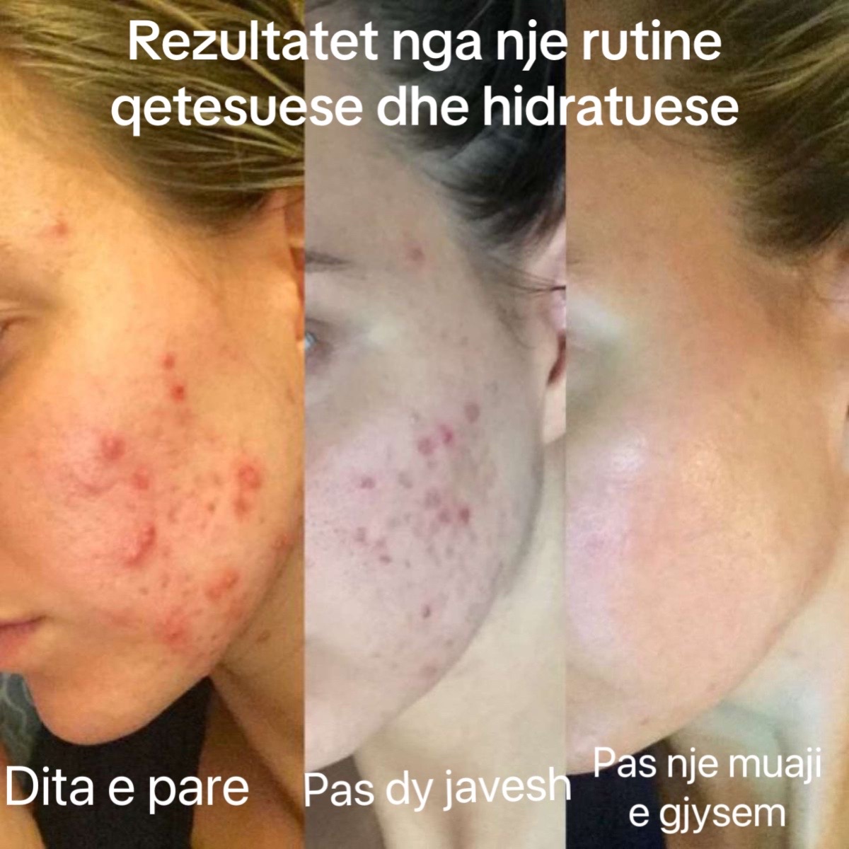 @RadiantSkin.al