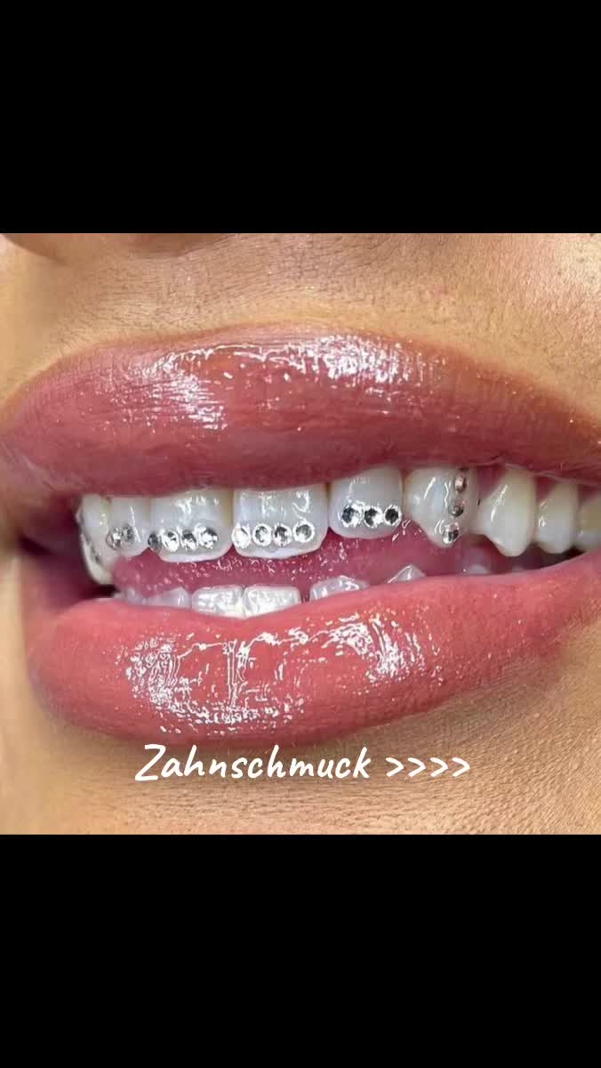 @Zahnschmuck_