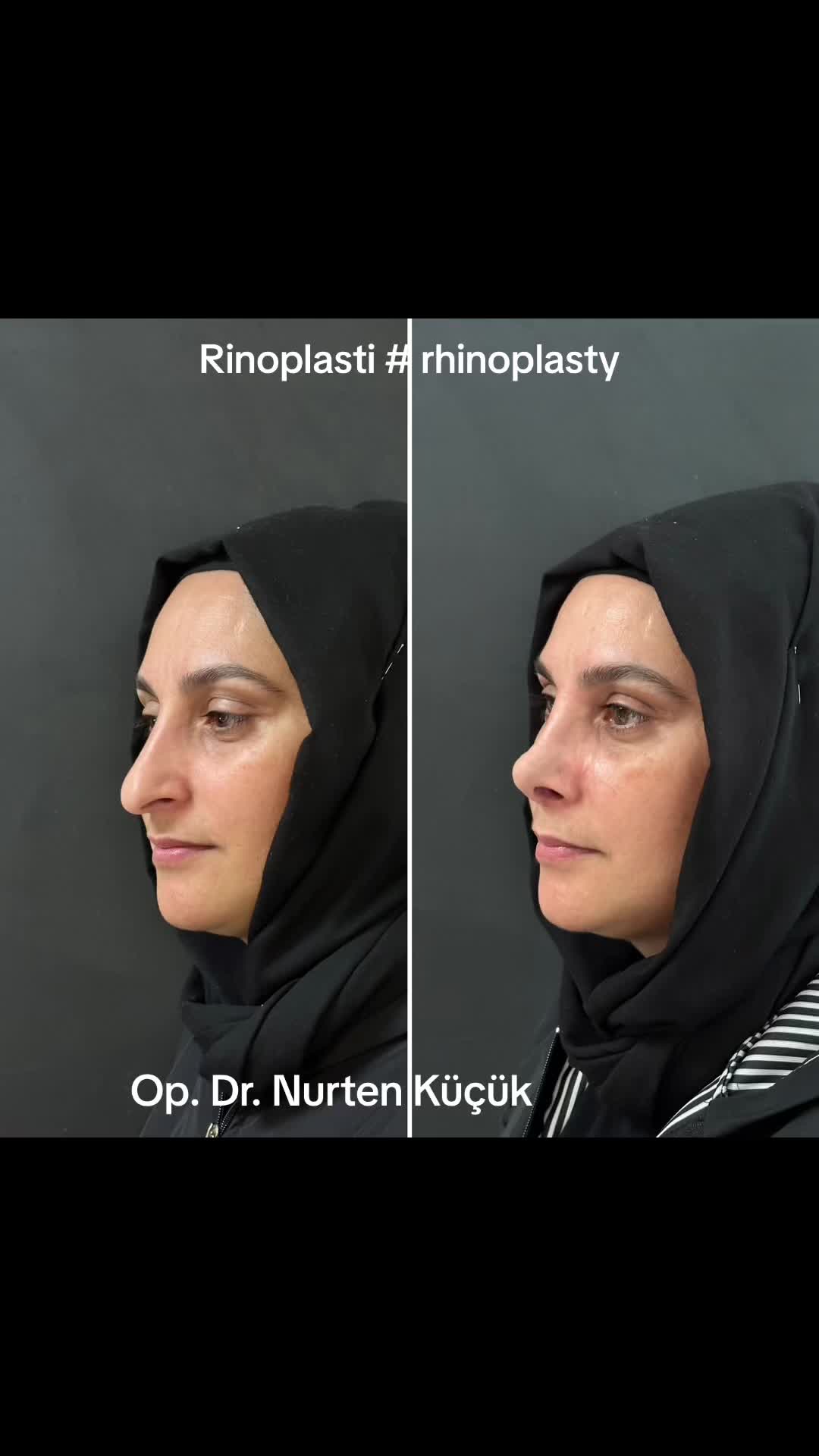 @Dr. NurtenKucuk