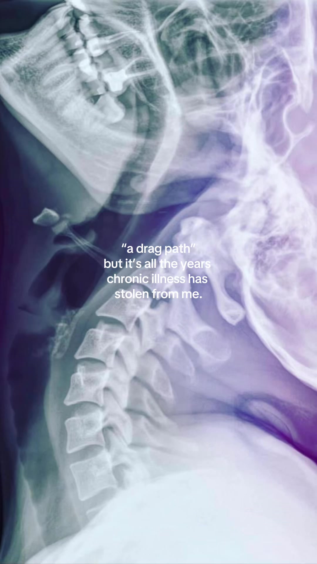 @𝔸𝔹𝔹𝕐