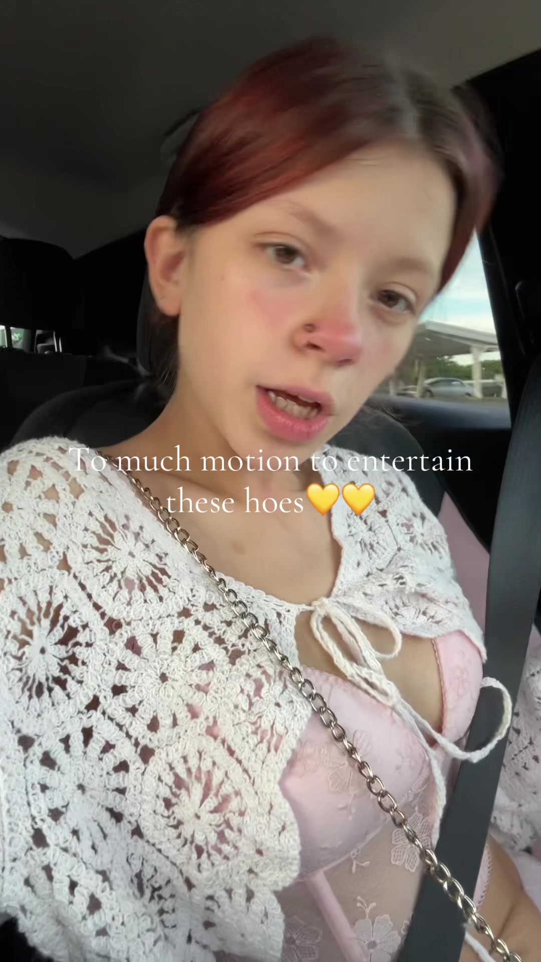 @Applesndpi
