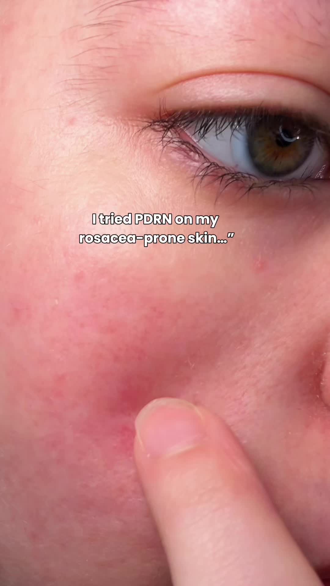 @Katie | Olive Skin + Beauty