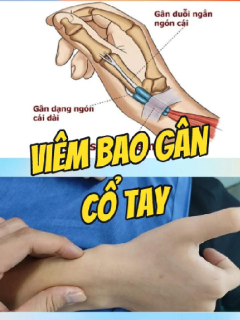 @Chuyên gia xương khớp