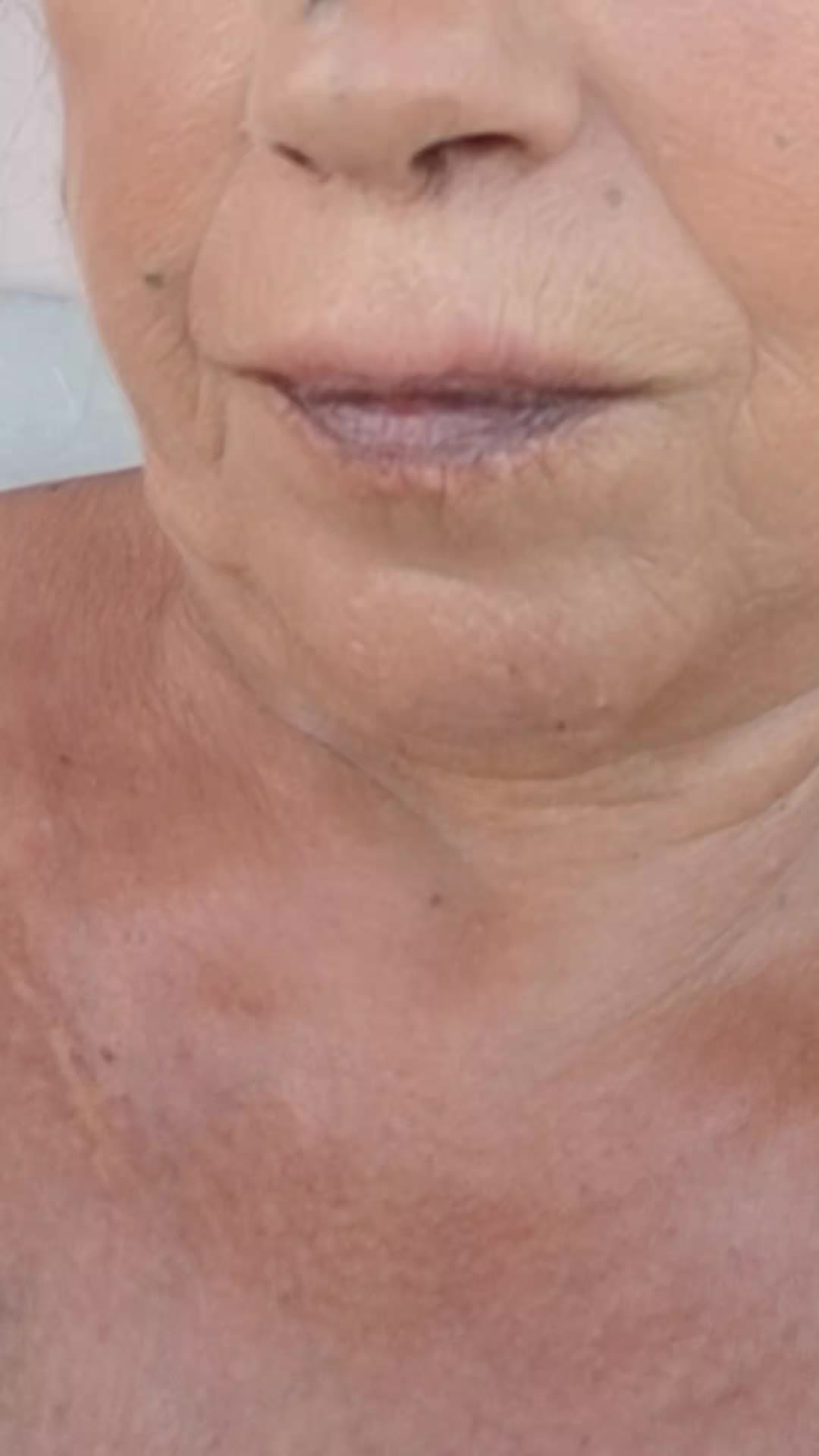 @Coccinella64