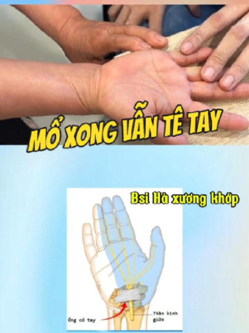 @Chuyên gia xương khớp