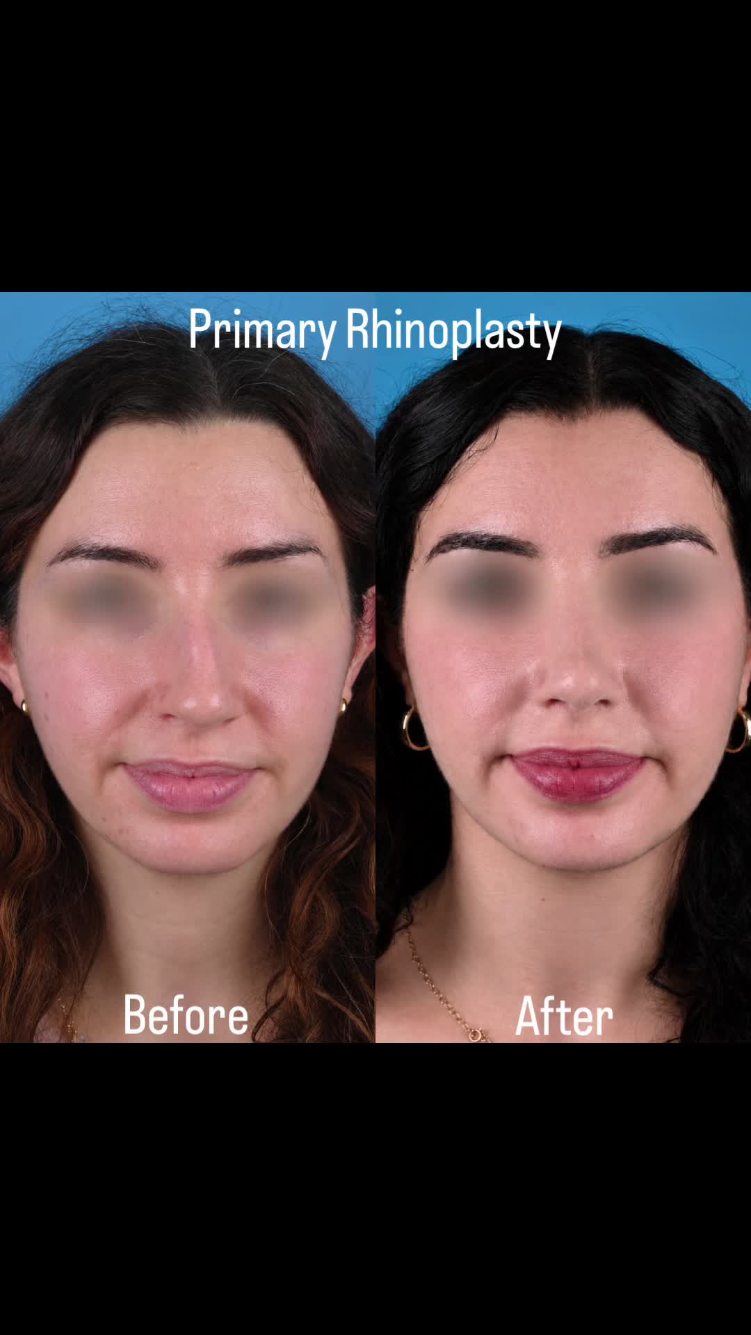 @Dr. Parit Patel, MD