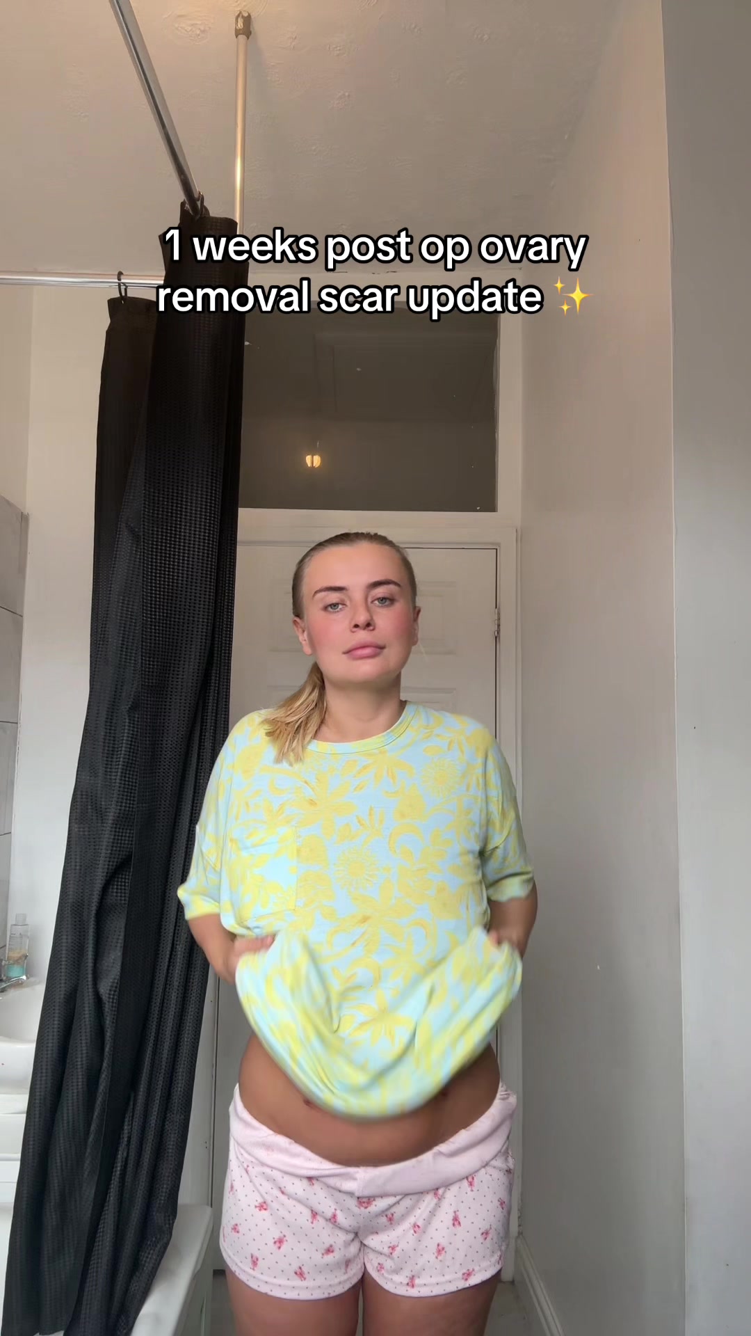 @lucyb_endoivfmumof2