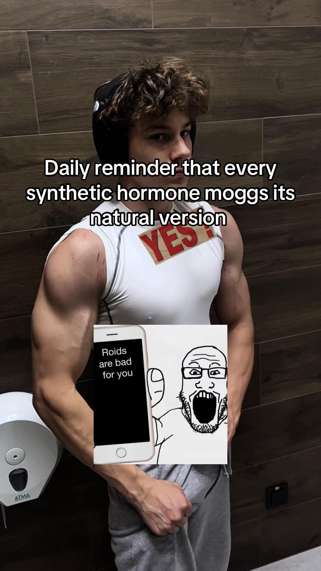 @Xander Lifts