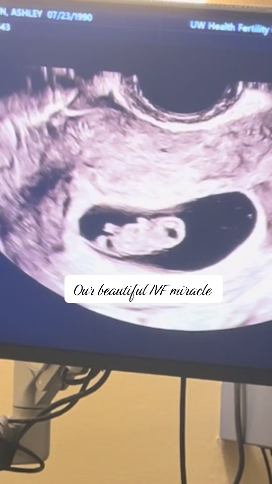 @Ashley Gorton | IVF Journey