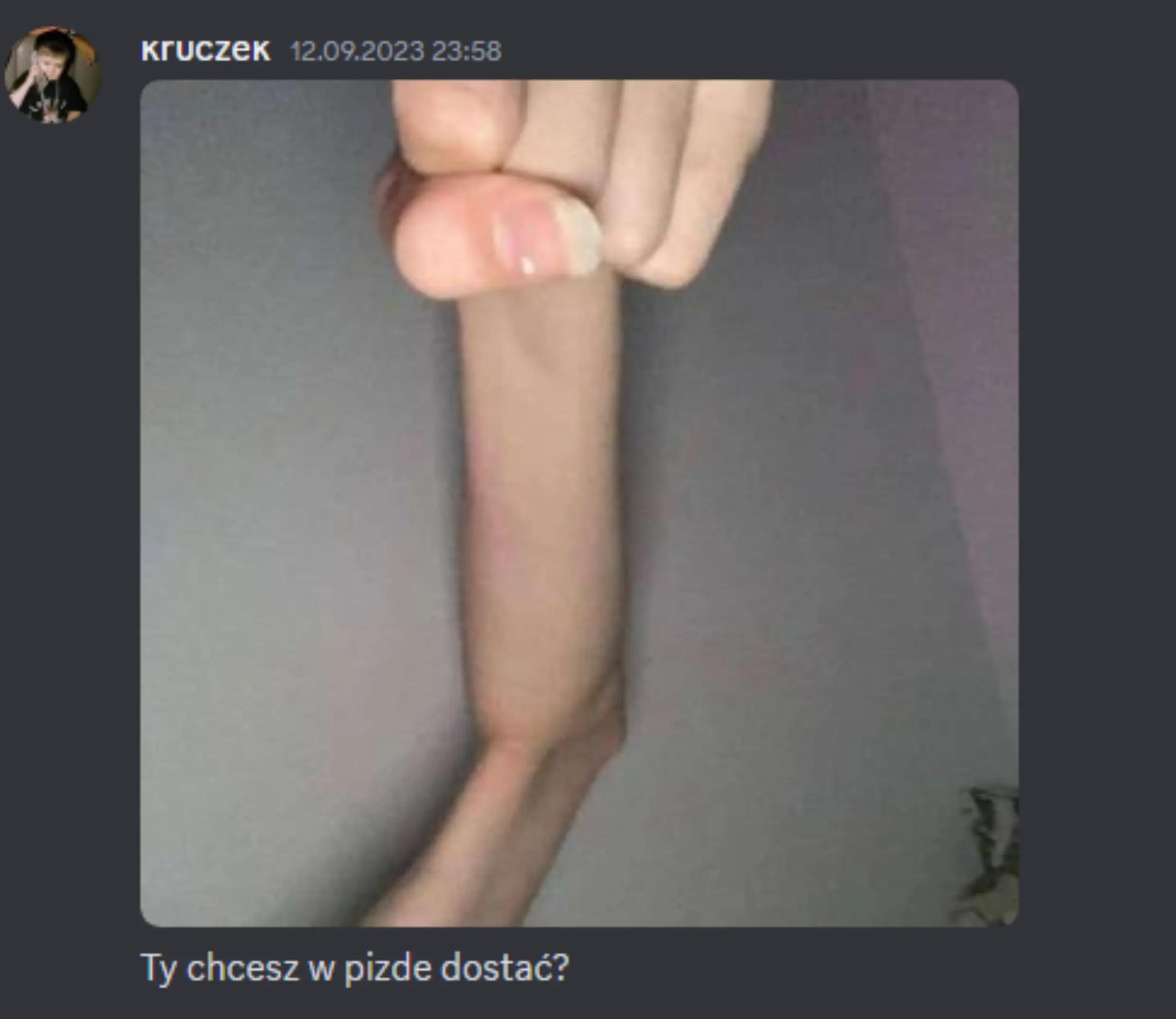 @🟥⬛🟥𝚇𝚒𝚖𝚒𝚔🟥⬛🟥