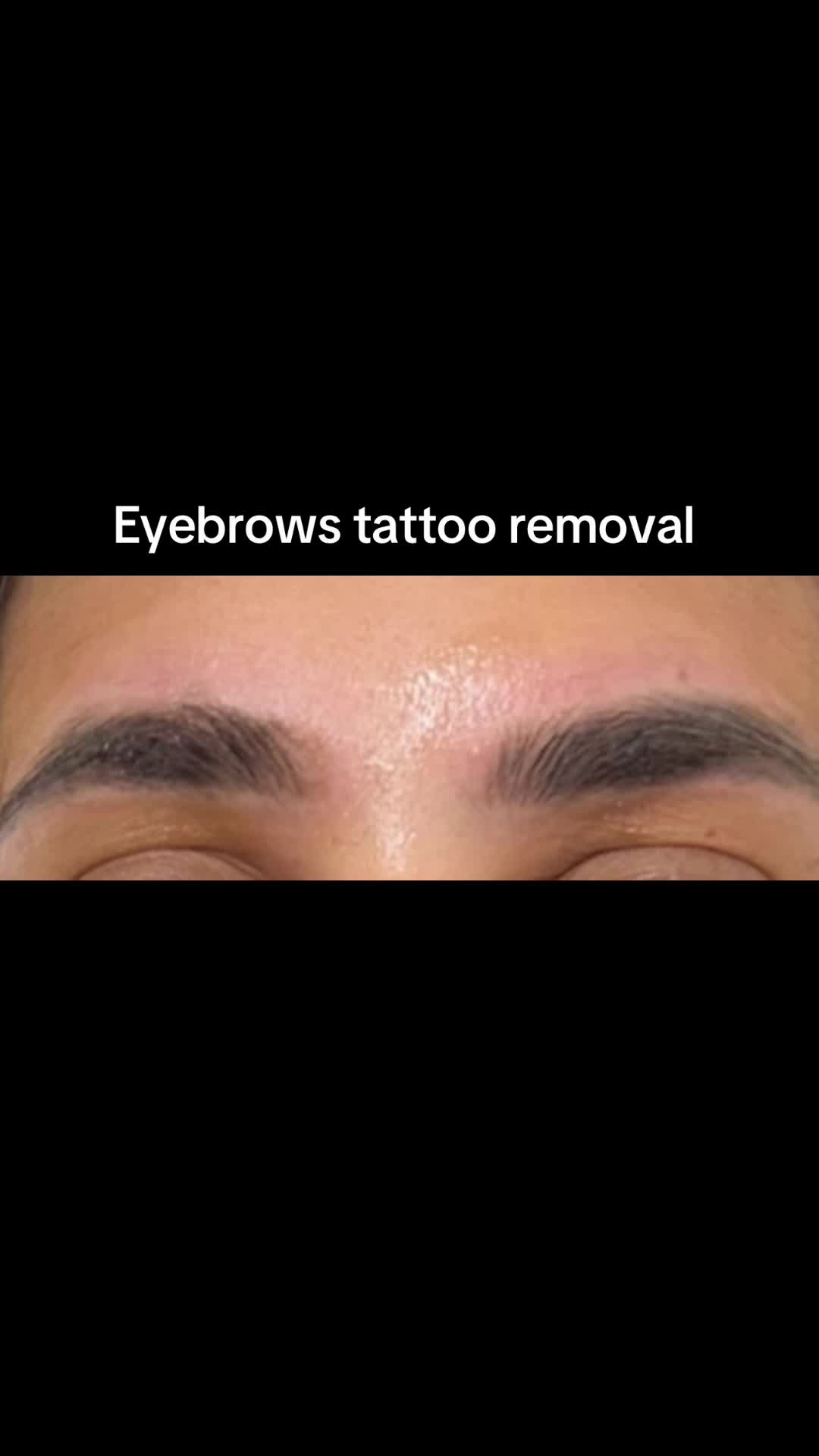@Zeiva laser /Dearborn MI