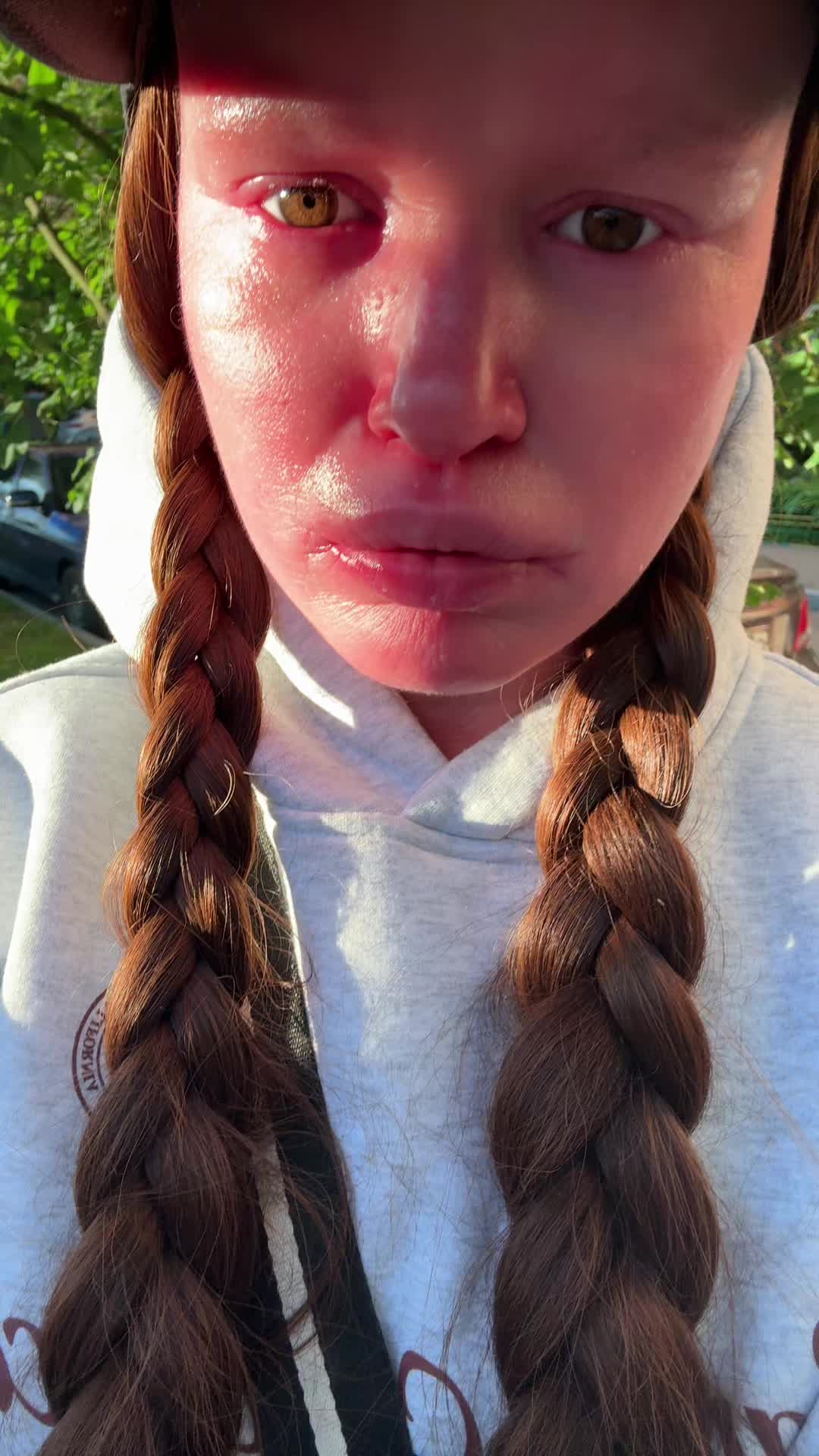 @Toxxzaaa