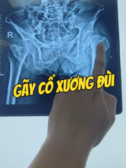 @Chuyên gia xương khớp