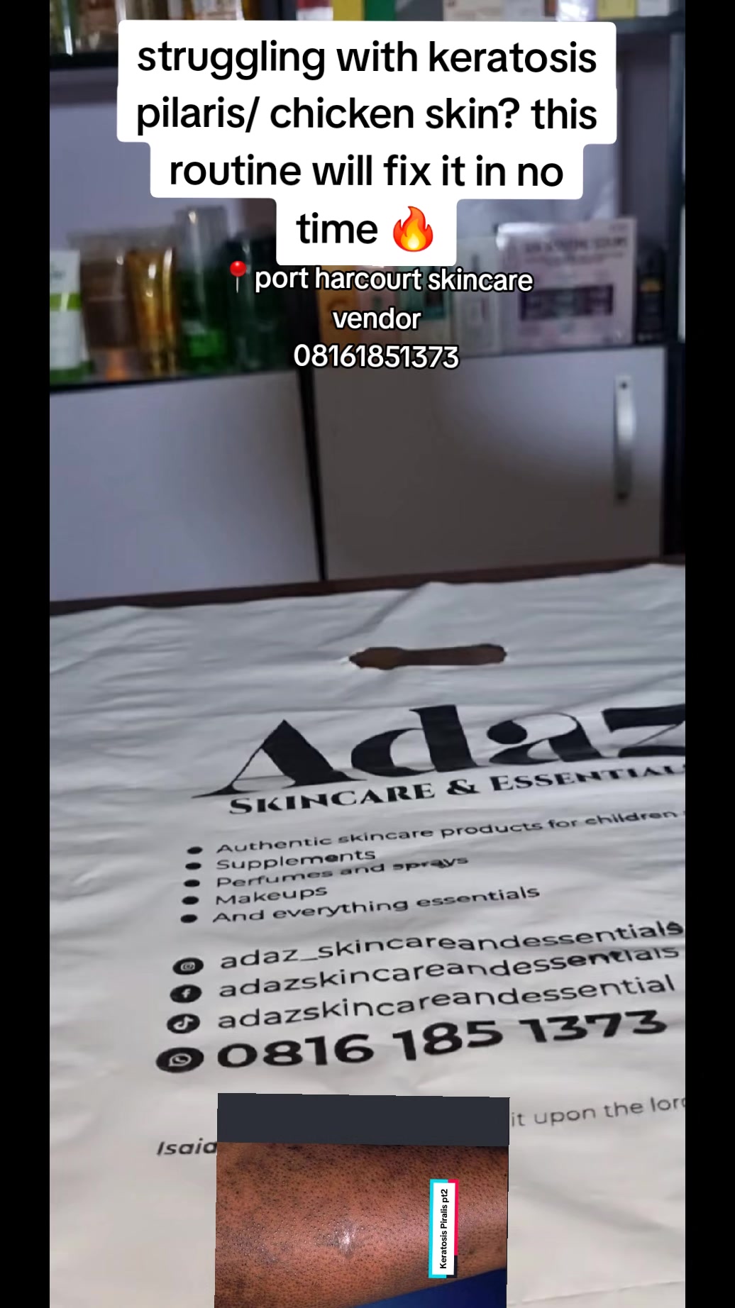 @Adazskincareandessentials