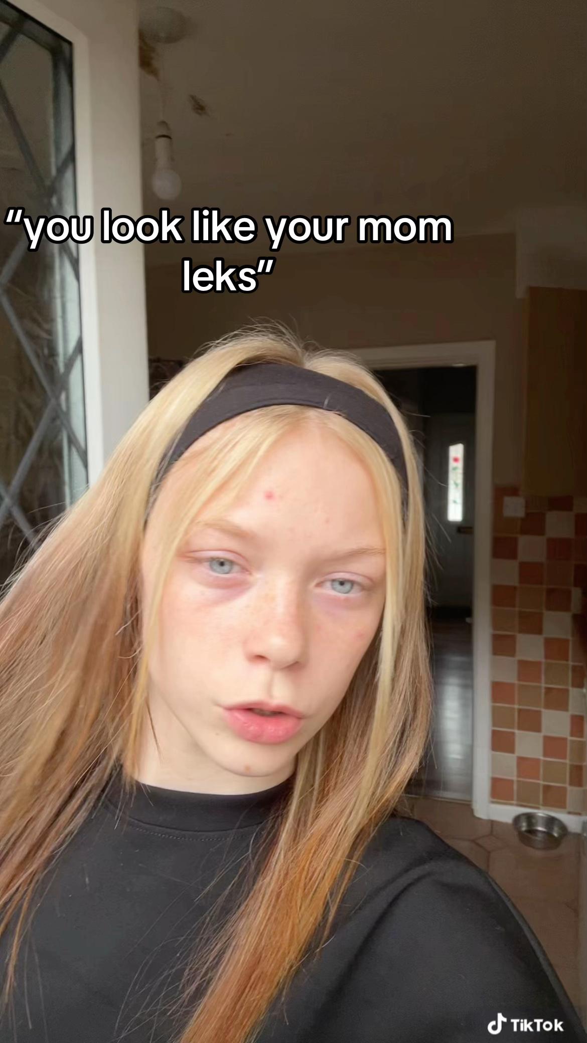 @leks