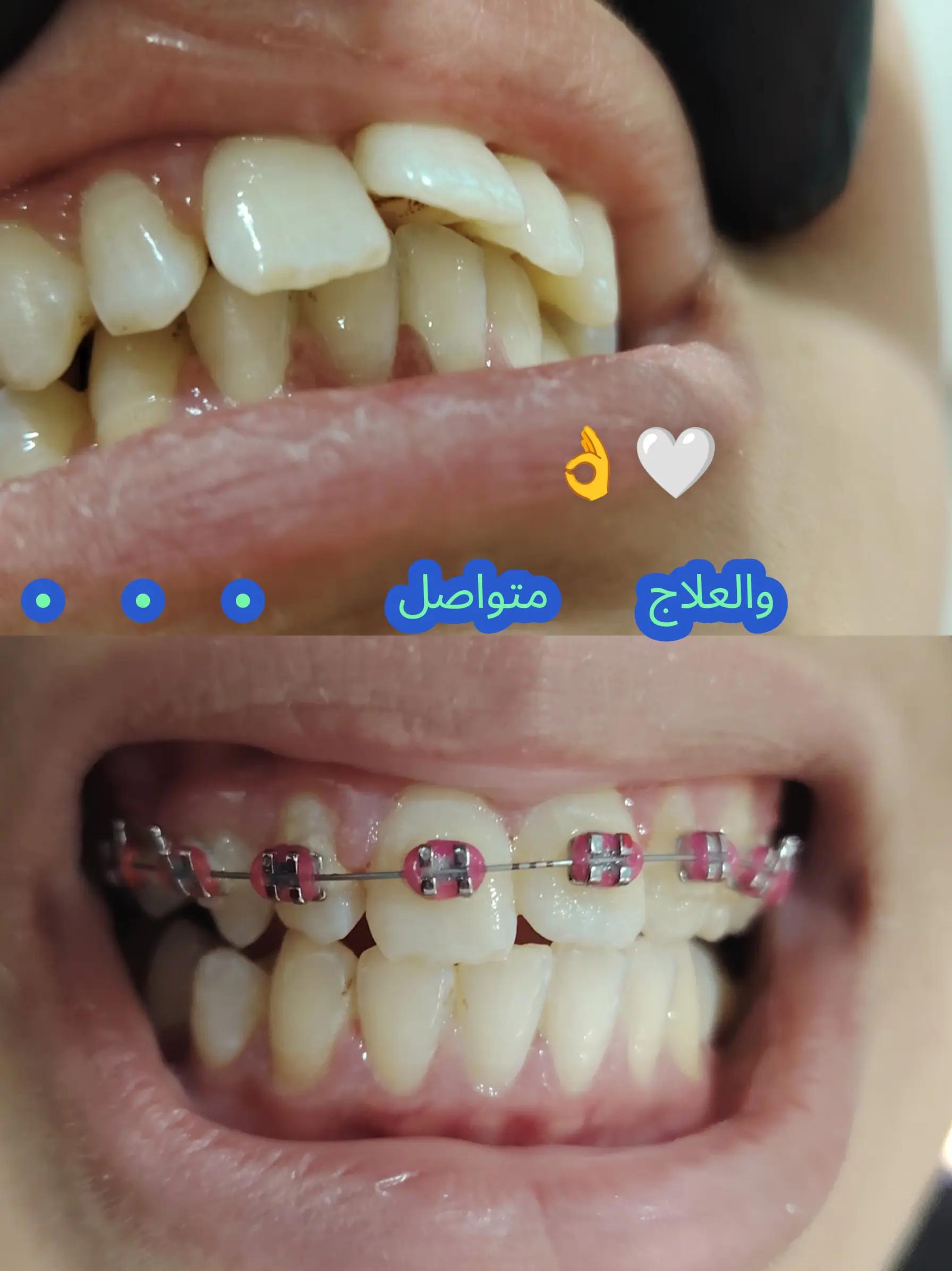 @Dr HASSOUN02 طبيبة الاسنان شلف