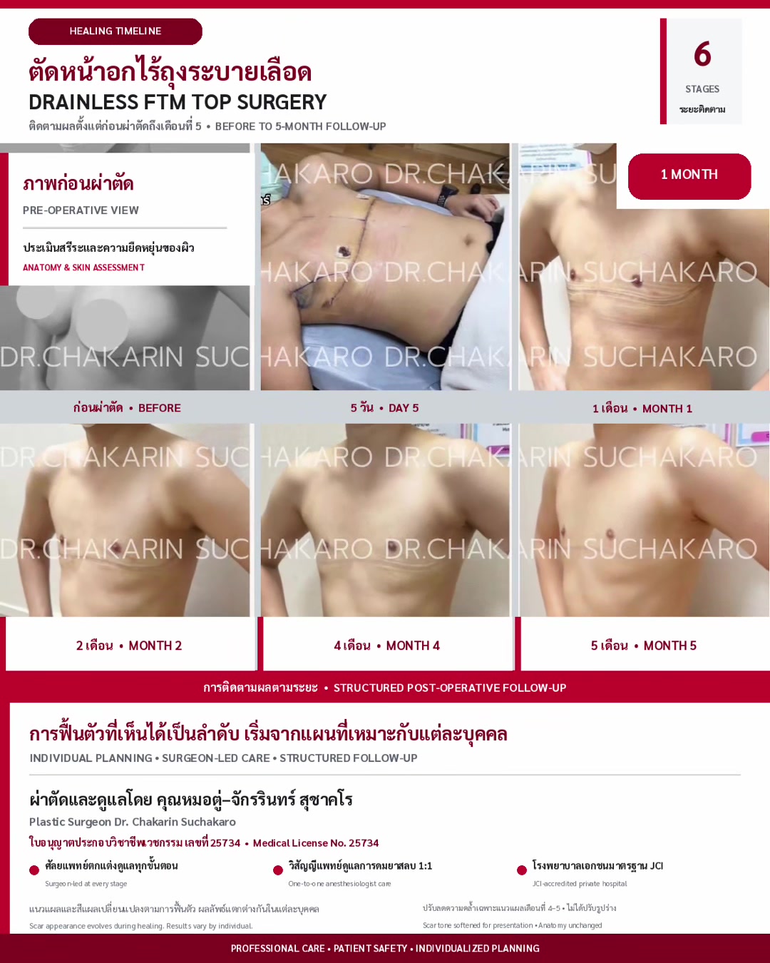 @Dr.Chakarin-team