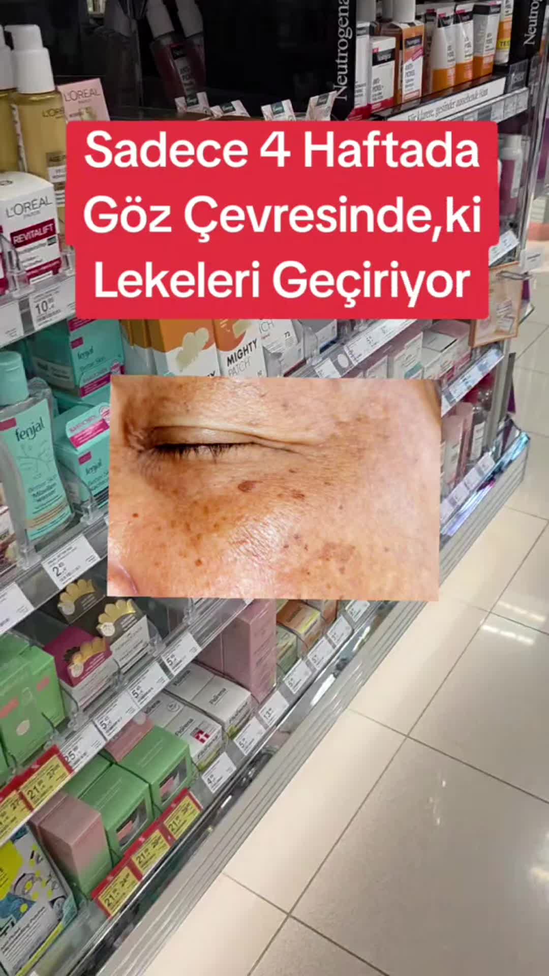 @Gurbet Ana
