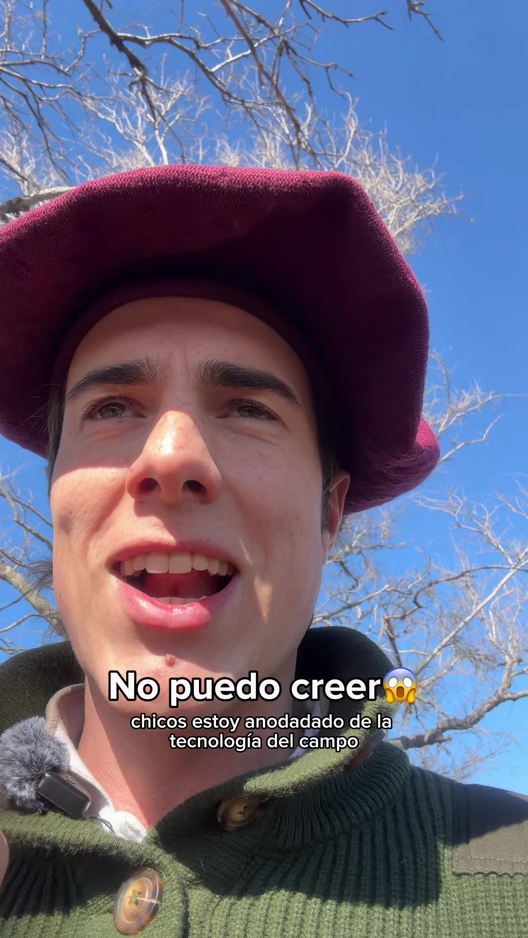 @Cristóbal Combes