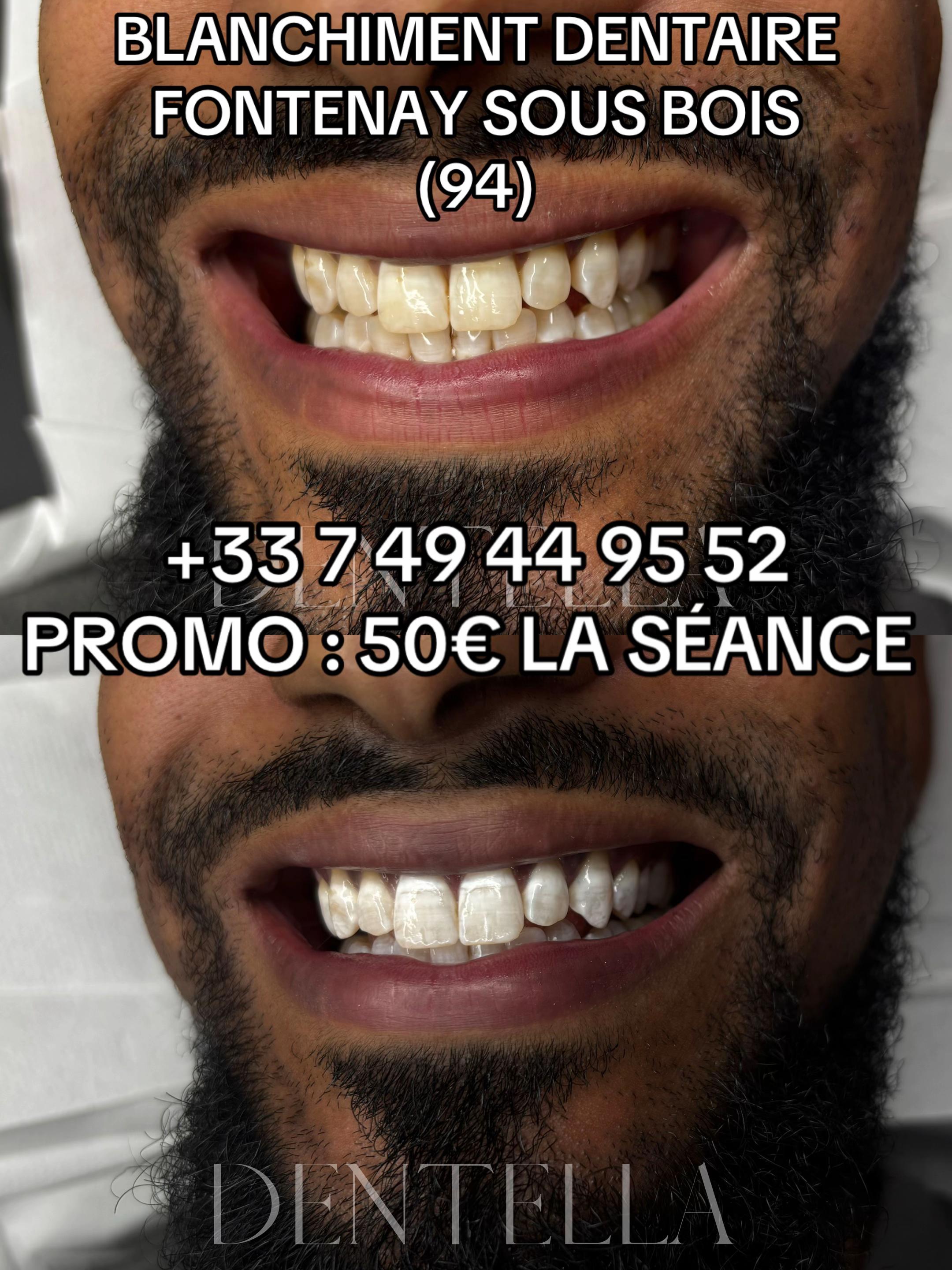 @Dentella