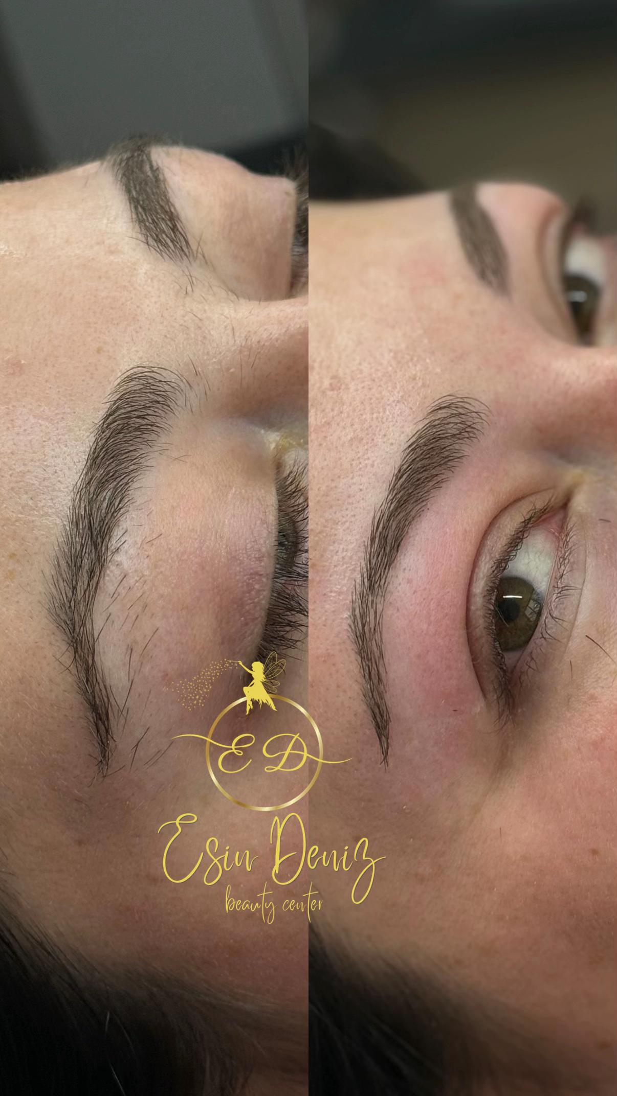 @Esin Deniz Beauty center