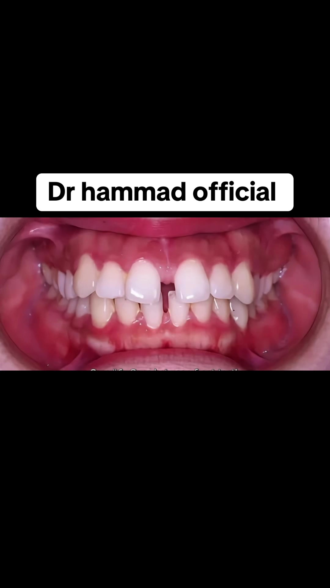 @🥀Dr_Hammad_official🥀