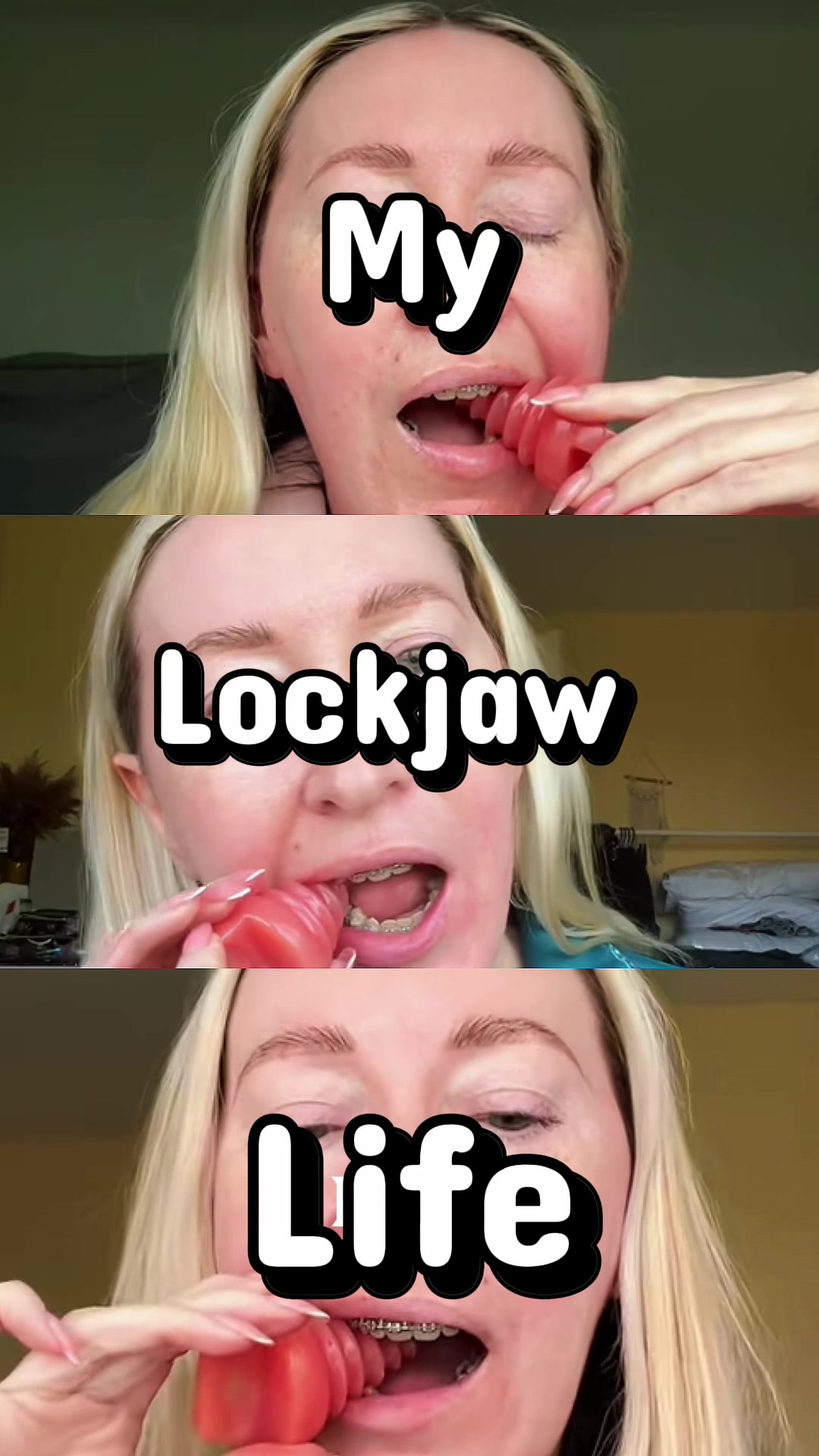 @Mylockjawlife