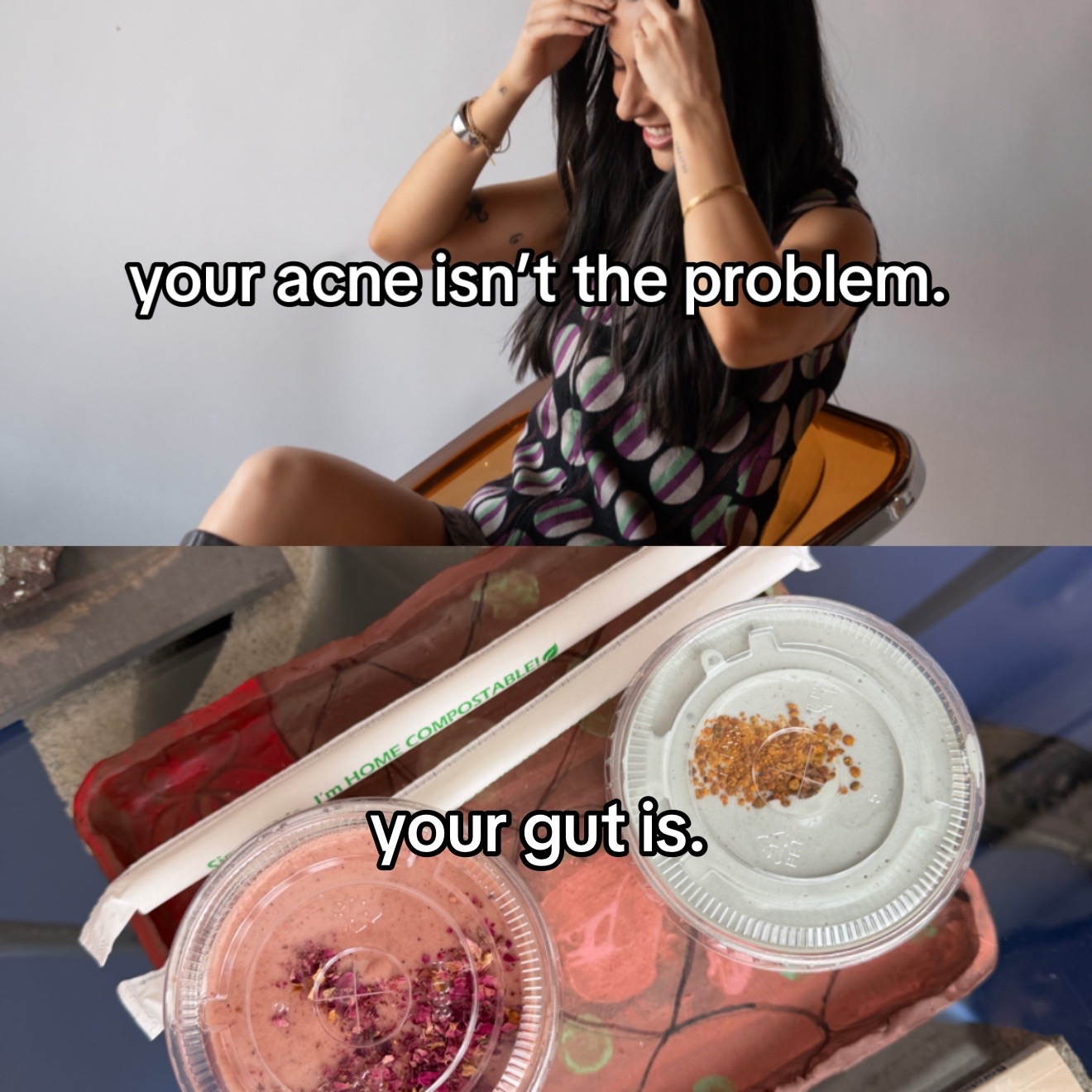@Doctor Sheyda | Acne Expert