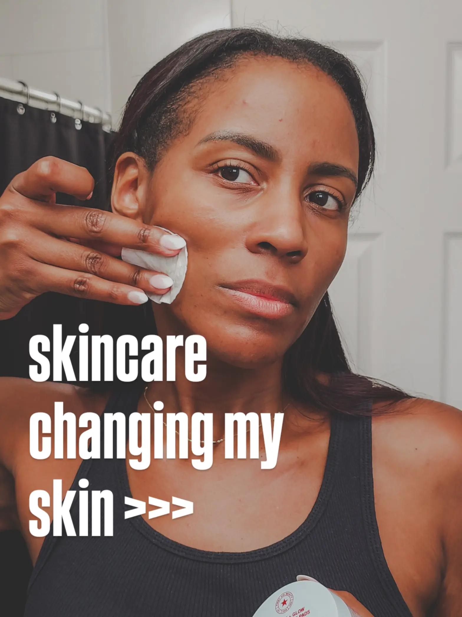 @Elizabeth E | Life Over 40