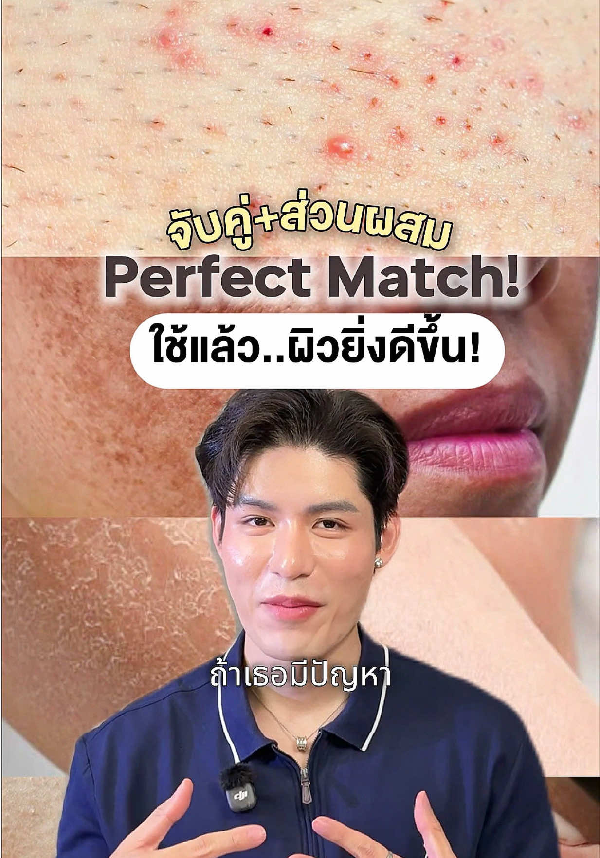 @หนูปอนด์ที่ชอบเลเซ่อร์