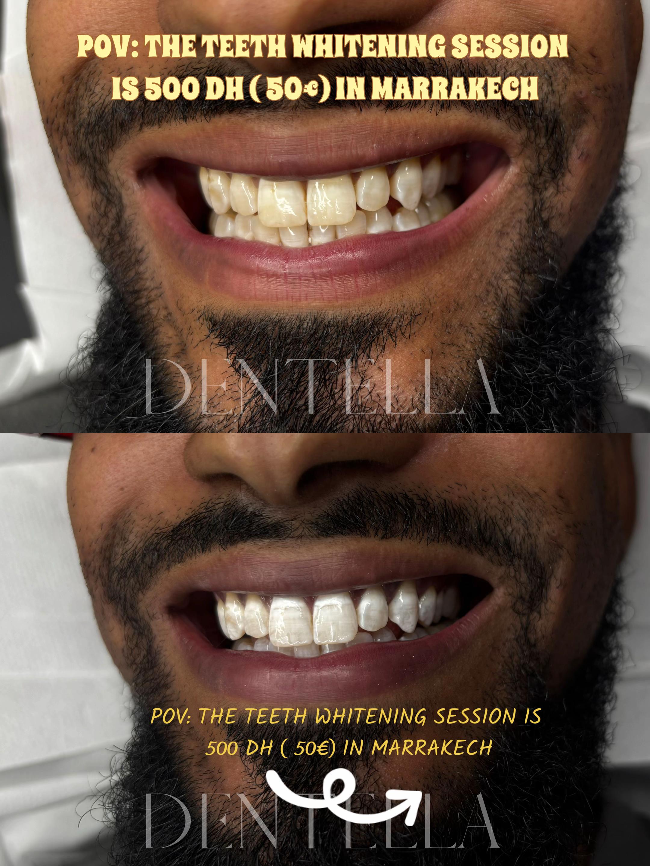 @Dentella