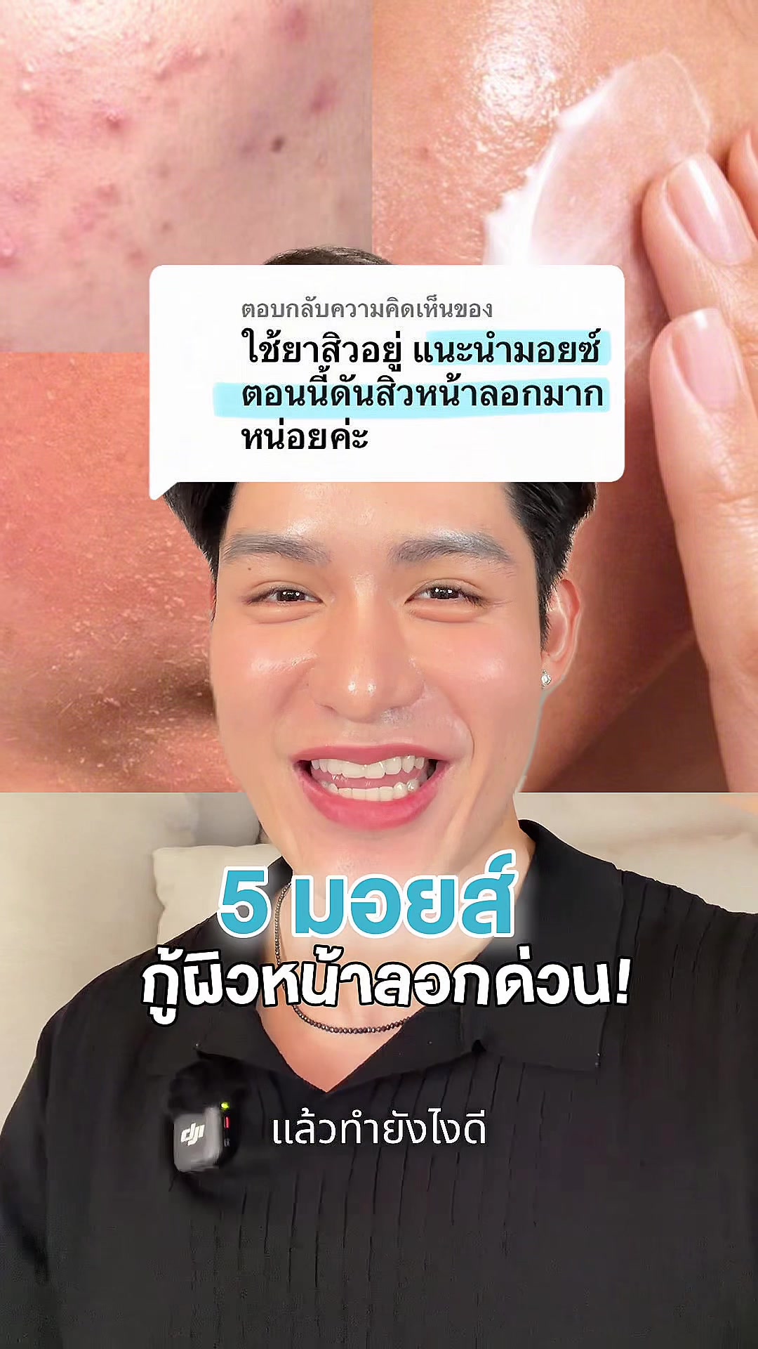 @หนูปอนด์ที่ชอบเลเซ่อร์