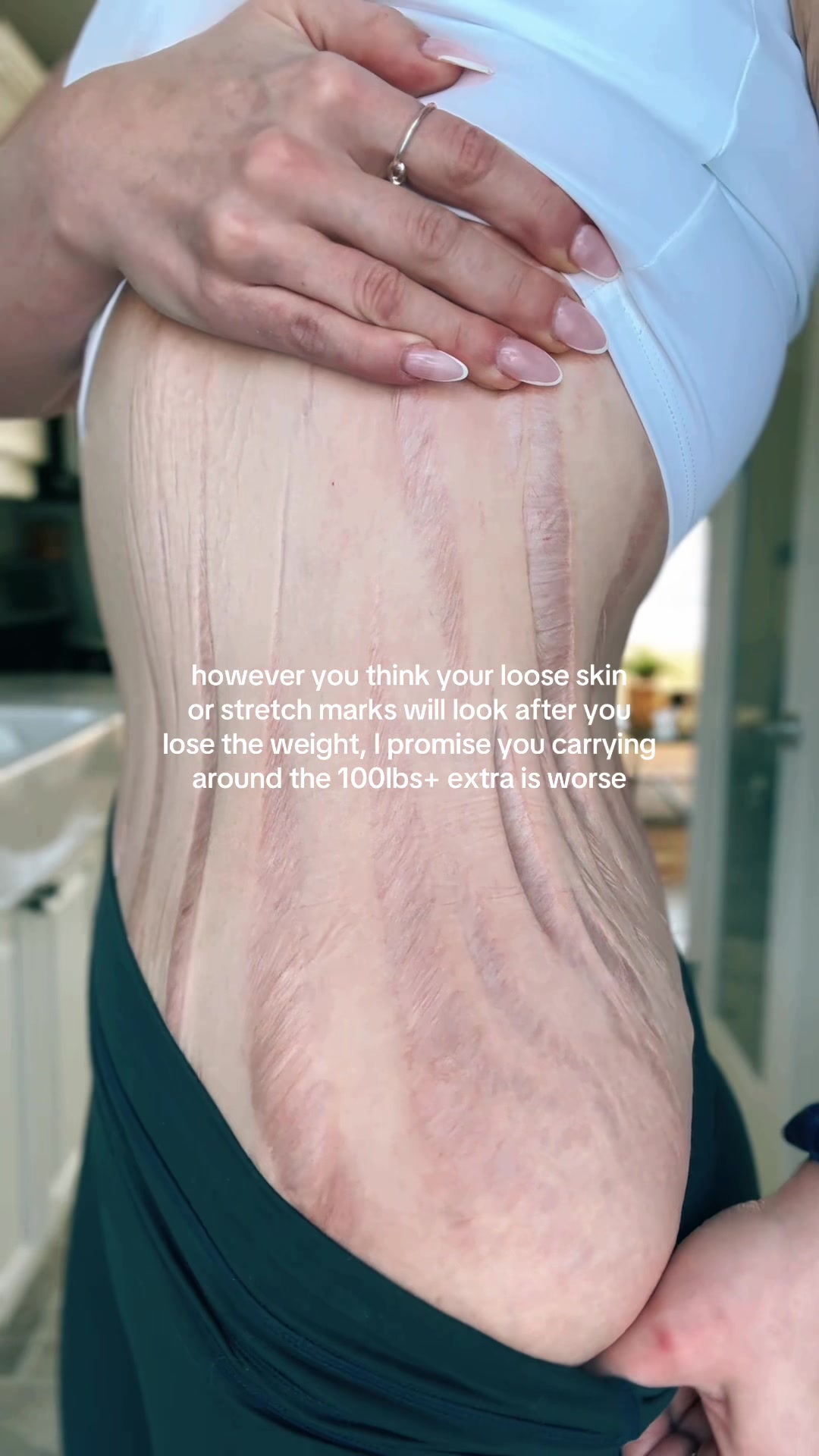 @Emma | weight loss & life